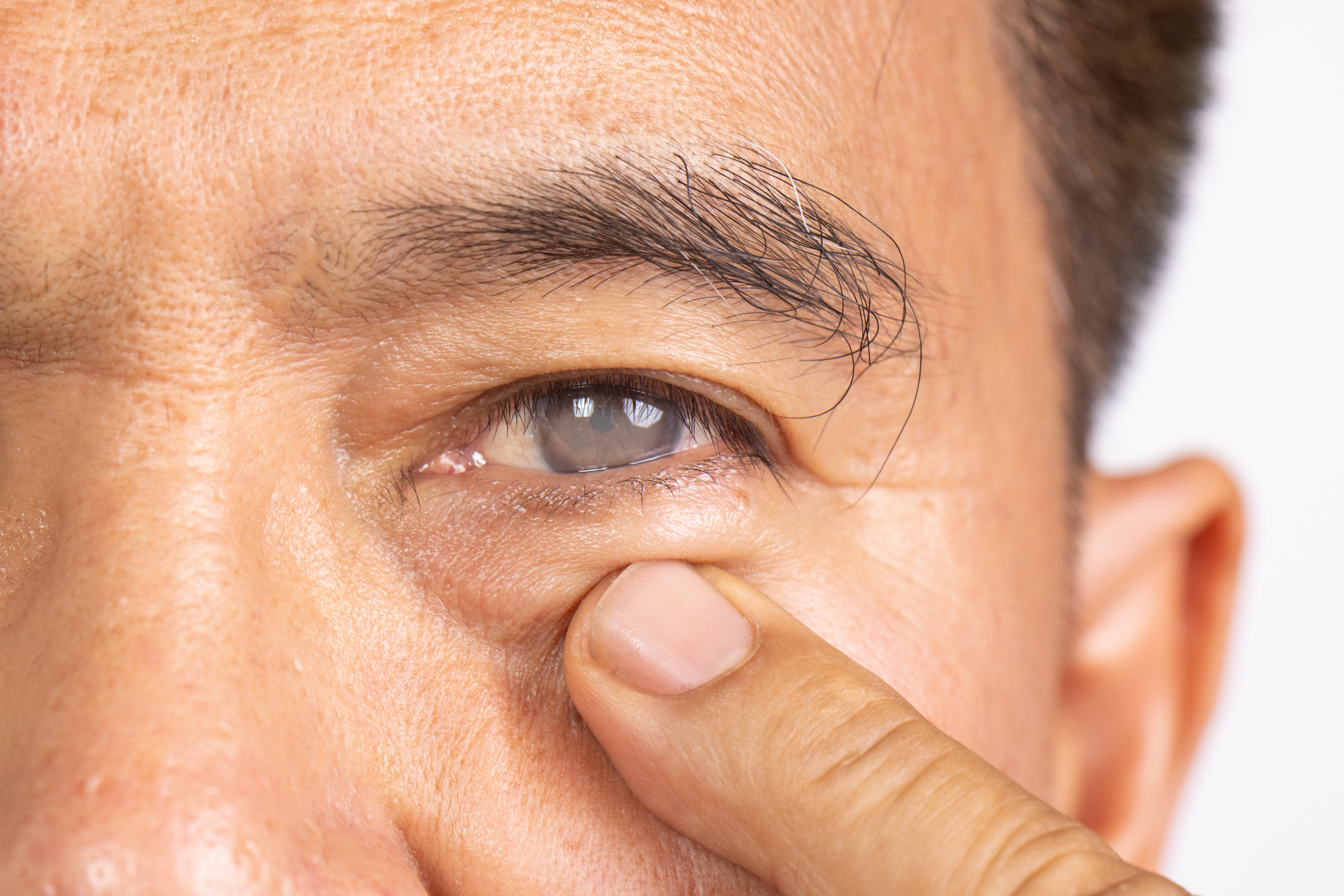 A close up of the face of an older man who is pointing at his eye with a finger.