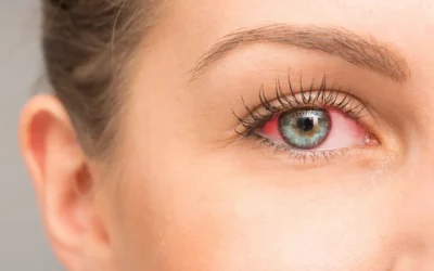 Watery Eyes: Common Causes and Solutions 