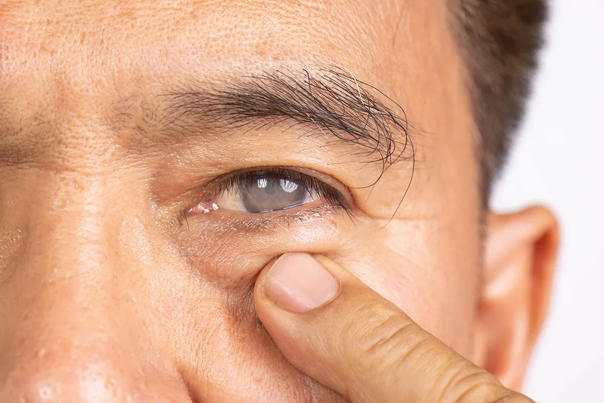 A close up of the face of an older man who is pointing at his eye with a finger.